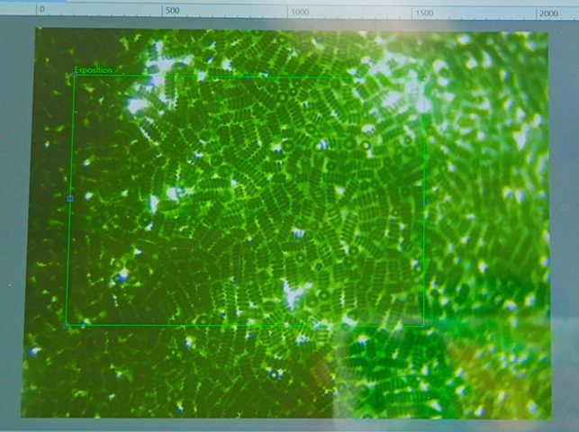 4–Observation-au-microscope